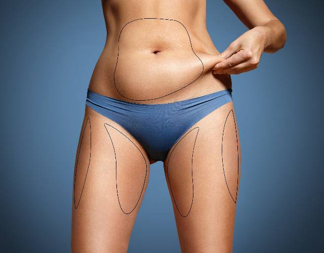 Lipo Não-Cirúrgica